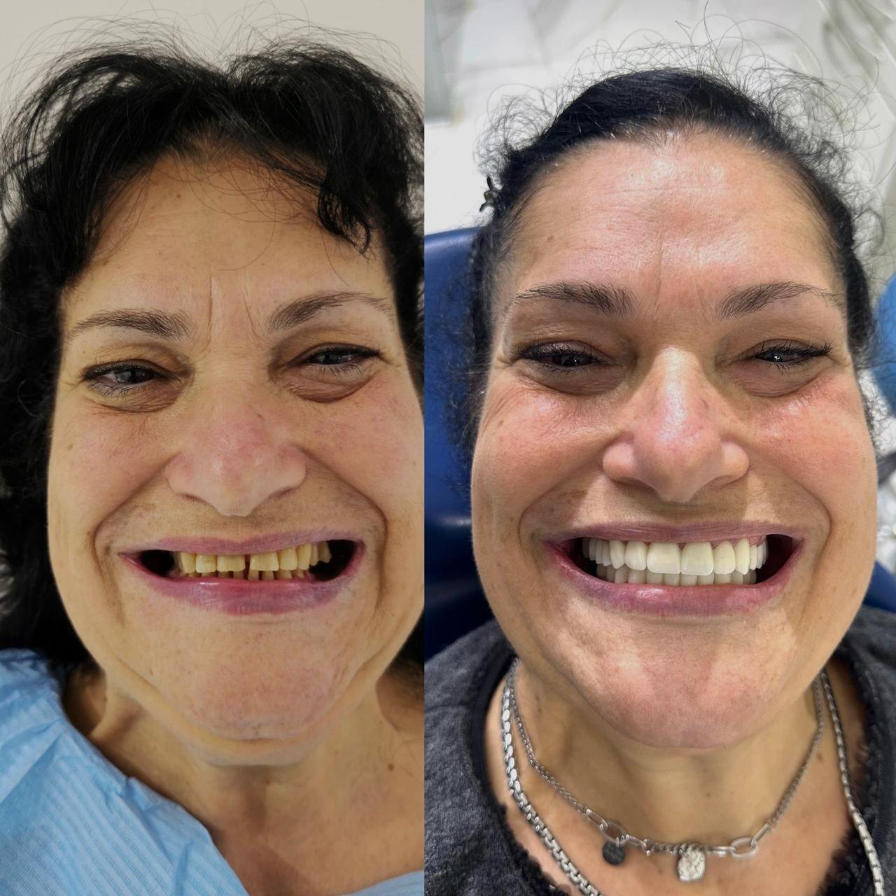Prima e dopo Eurovita 4